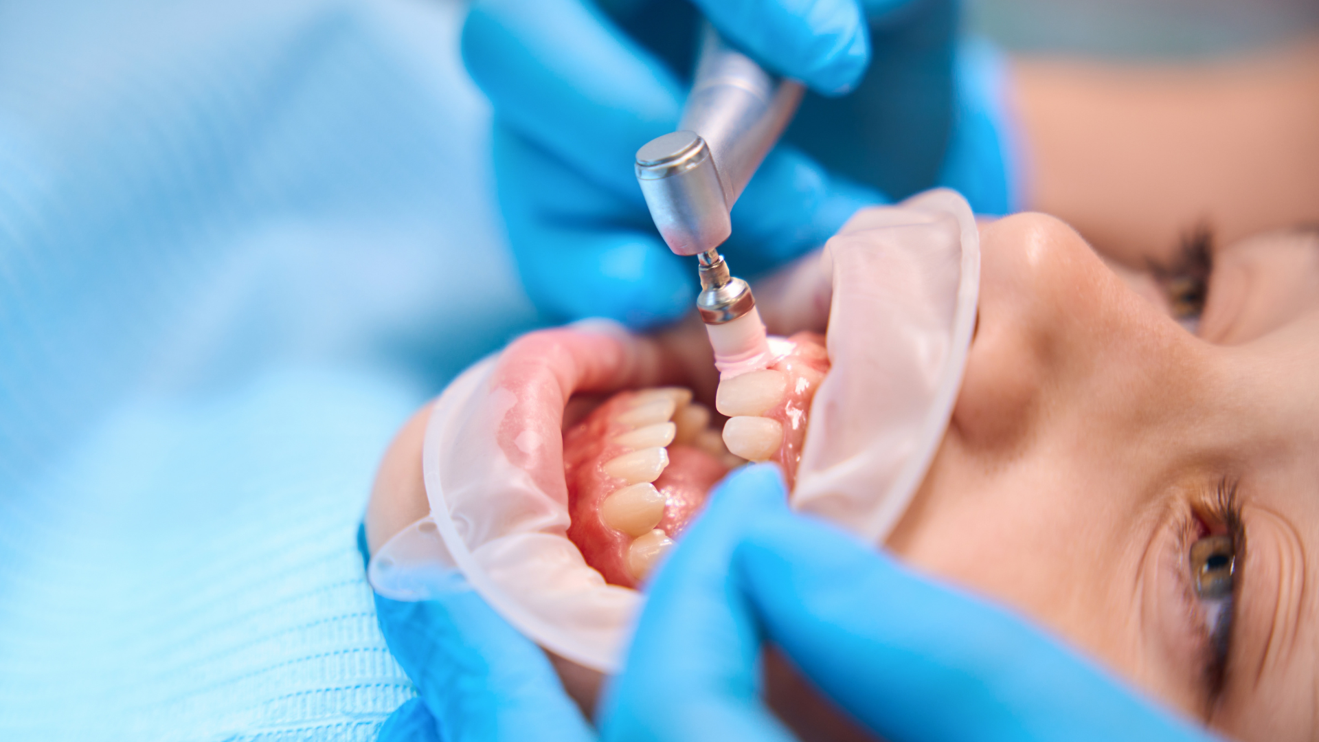 Dentisterie WEB Service ProtheseFixe 1920x1080