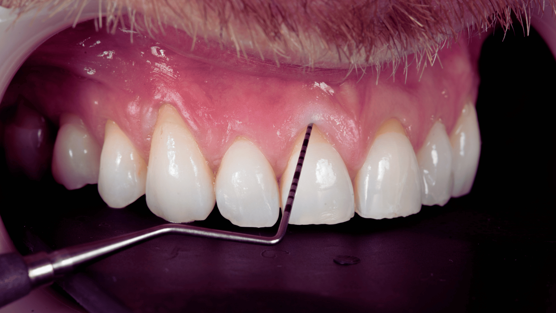 Dentisterie Parodontologie 1920x1080